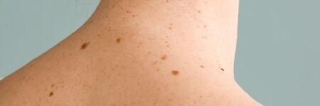 Qual será o significado dos sinais no rosto e no corpo?